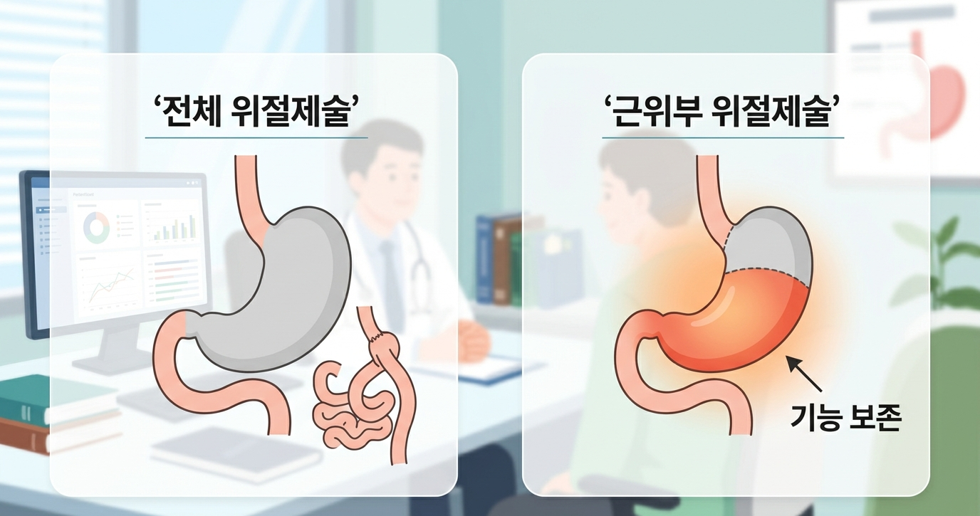 위 일부만 절제하는 위암 수술, 근위부 위절제술 치료 효과 확인
