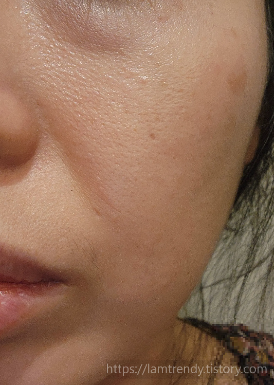 현재 내 피부상태 눈밑꺼짐