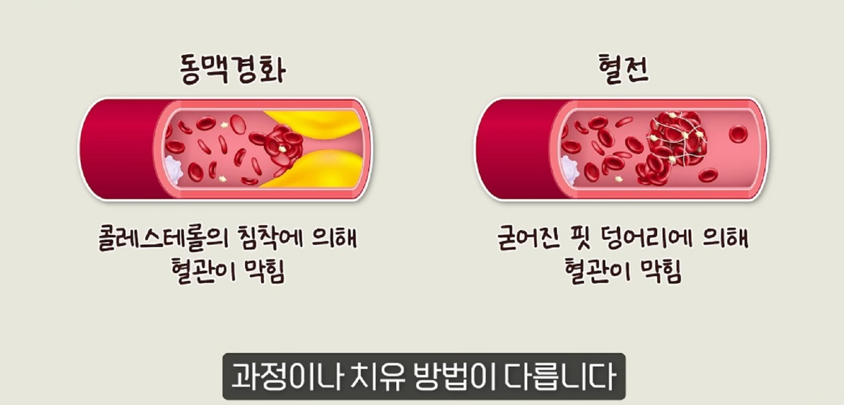 순환기내과-박성미-교수