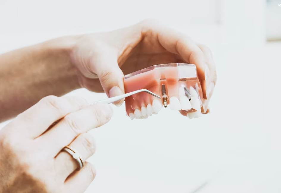 노인임플란트 국가지원