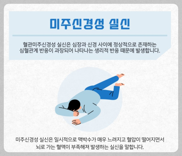 미주신경성 실신