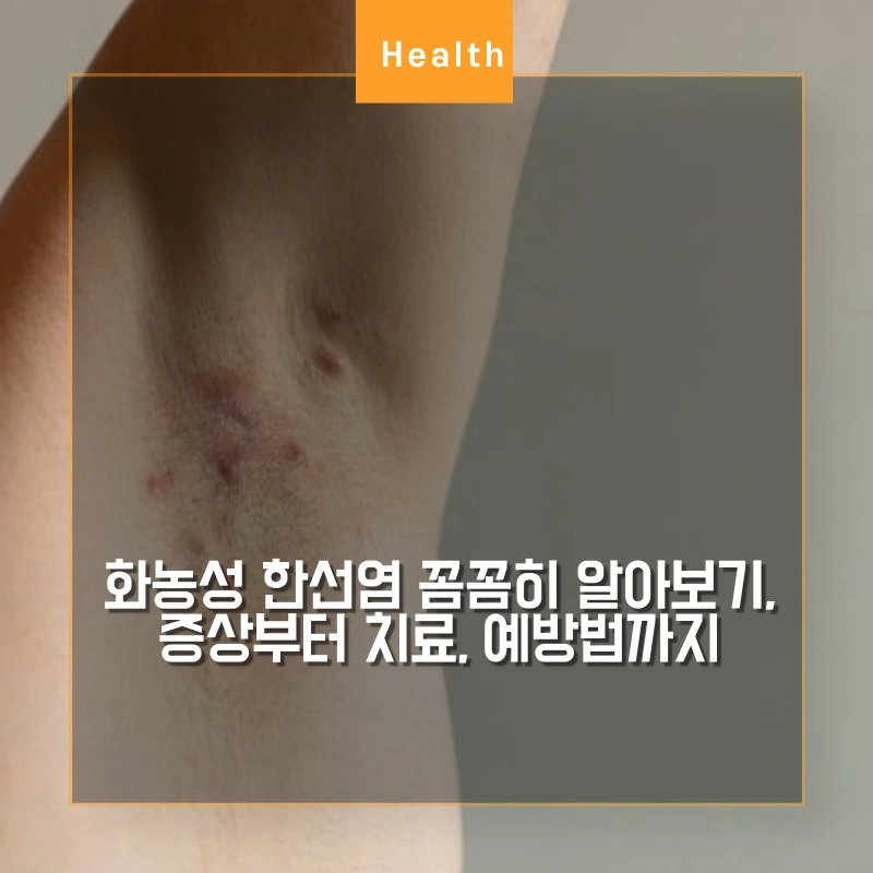 겨드랑이에 화농성 한선염 증상이 있는 썸네일