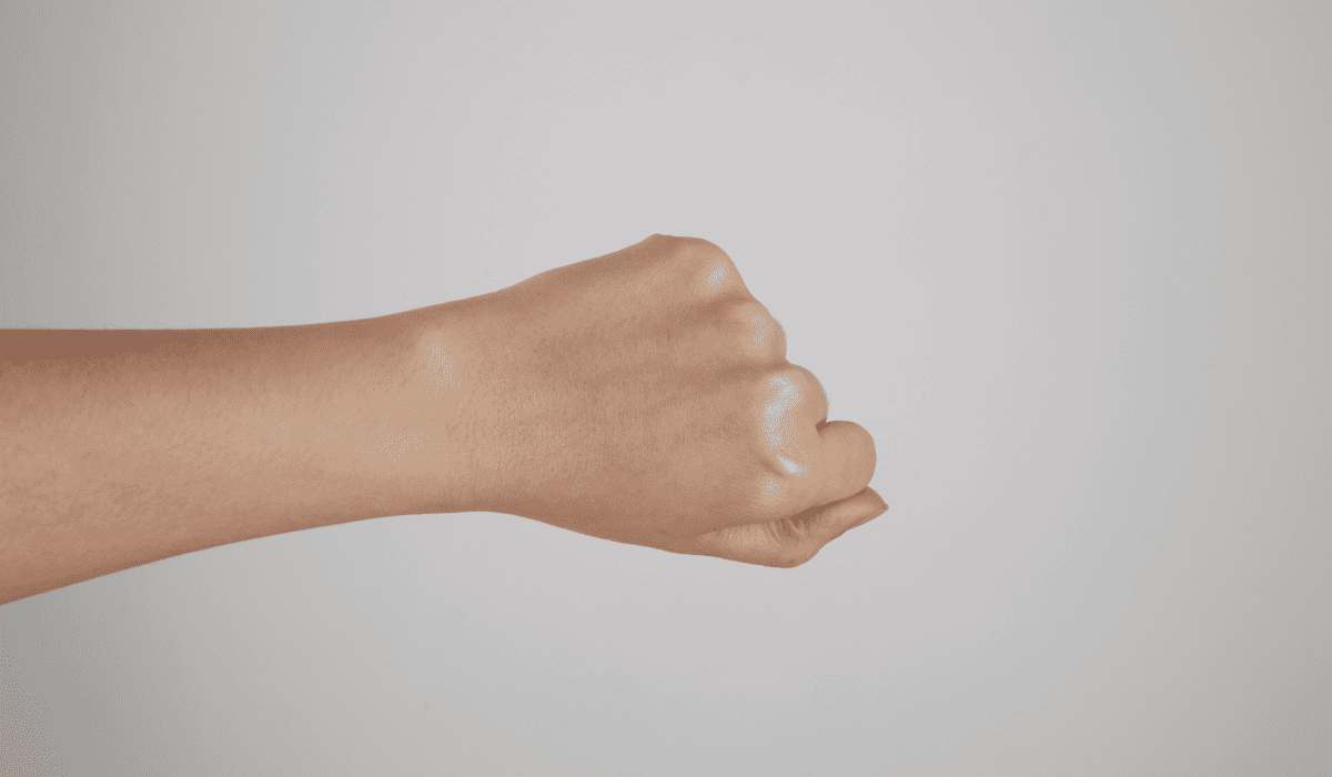 피부과_시술_종류_12