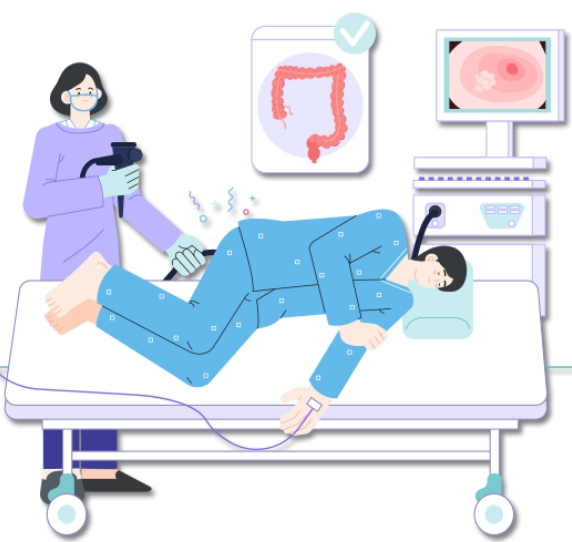 수면 대장내시경 검진을 묘사한 이미지로 환자가 수면유도 상태로 누워있고, 간호사가 내시경 관을 항문에 삽입하고 있습니다.