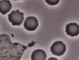 백혈구 수치가 낮은 이유 1