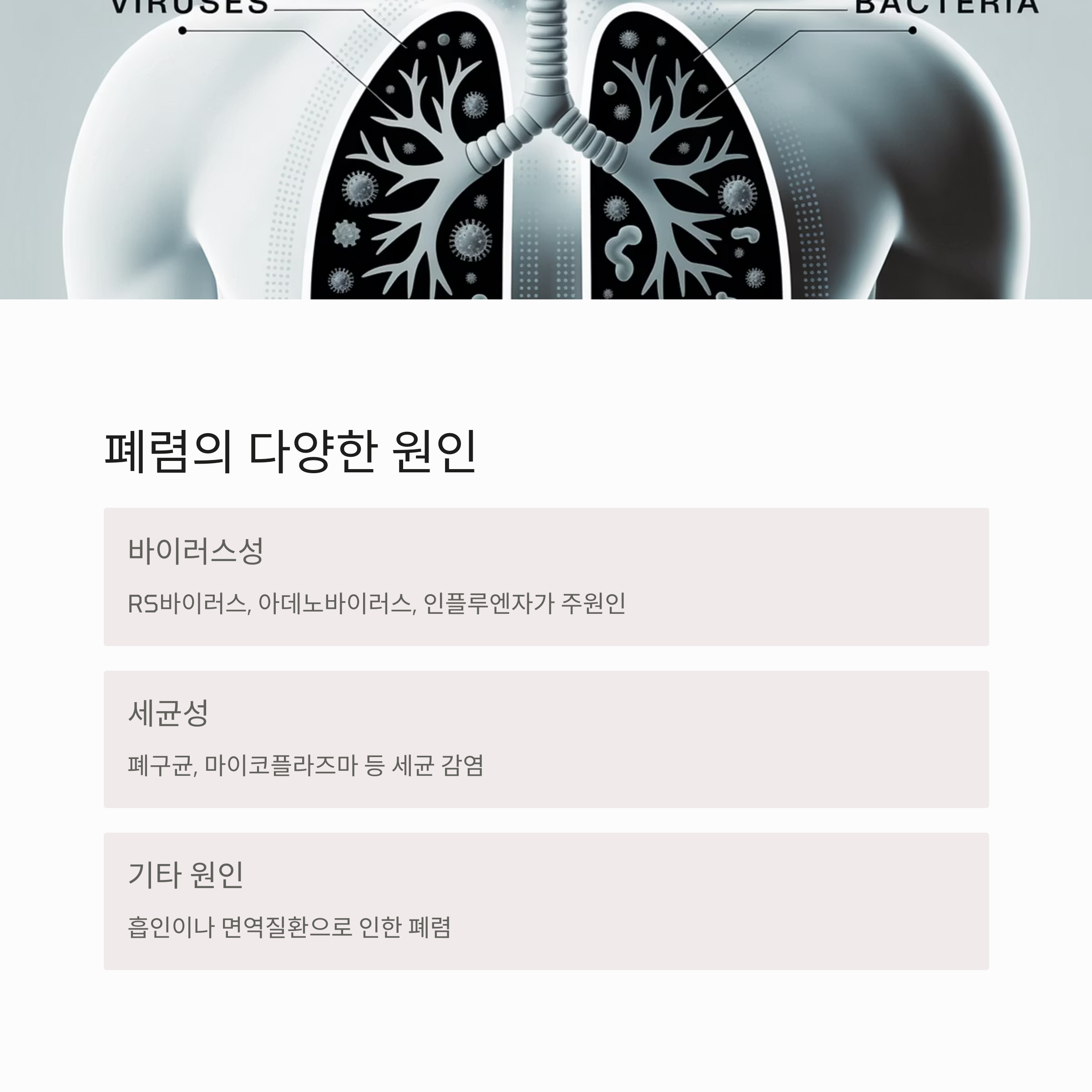 폐렴의 주요 원인인 바이러스성, 세균성, 기타 원인을 구분하여 설명한 인포그래픽 이미지