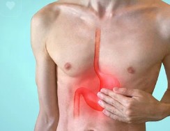 역류성 식도염 증상