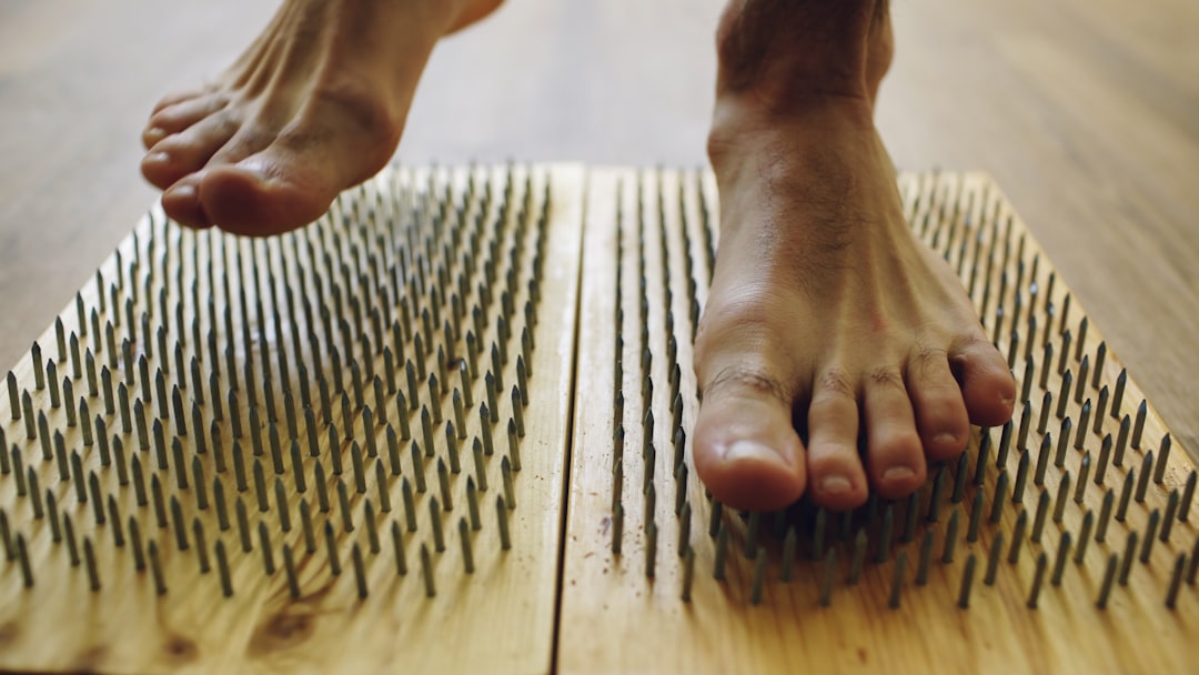 Acupuncture