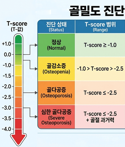 골다공증 수치보는법