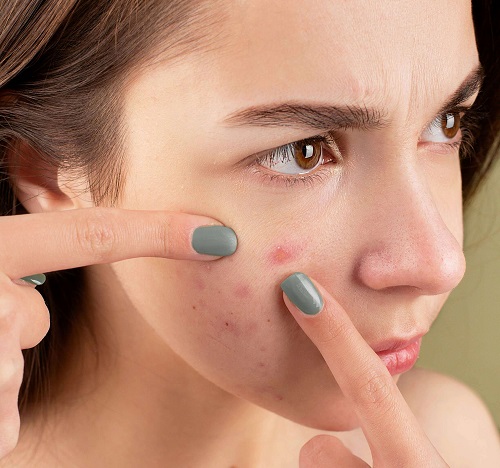 알레르기 접촉 피부염 원인과 증상