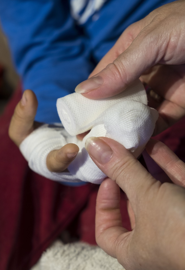 부상과 관련된 사진