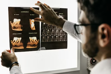 임플란트 시술과정 시술기간 시술 종류