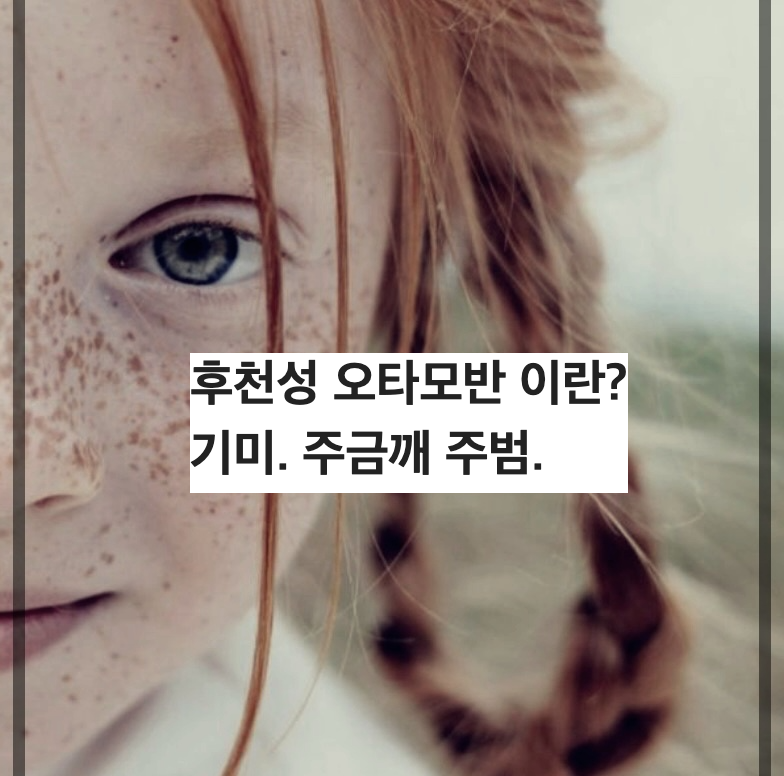 후천성 오타모반 이란?기미. 주금깨 주범.