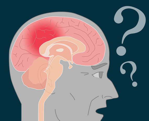 알츠하이머·파킨슨·혈관성 치매 차이점 총정리 + 증상 체크리스트