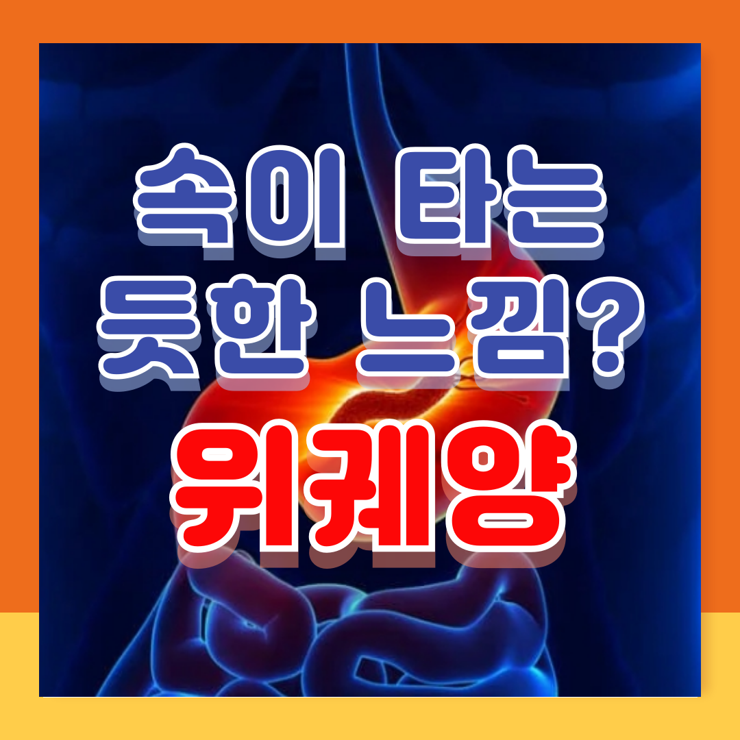 위궤양에 좋은 음식 증상 원인 치료 관리방법