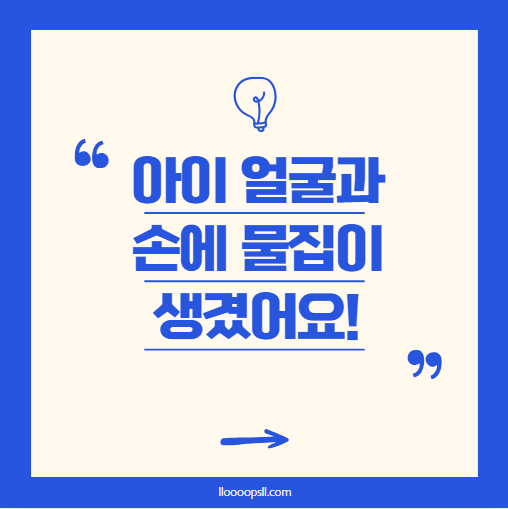 농가진(포도상구균 감염), 아이 얼굴과 손에 물집이 생겼어요!