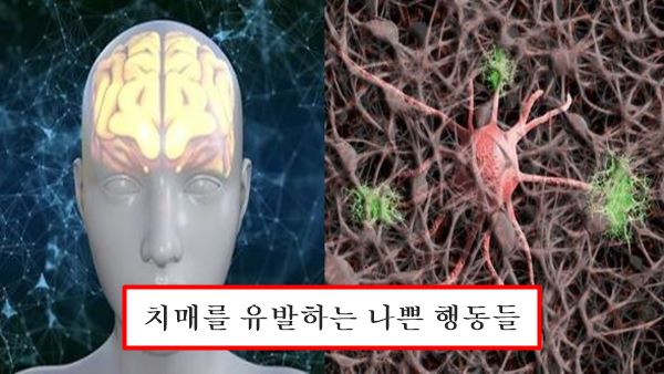 두뇌건강