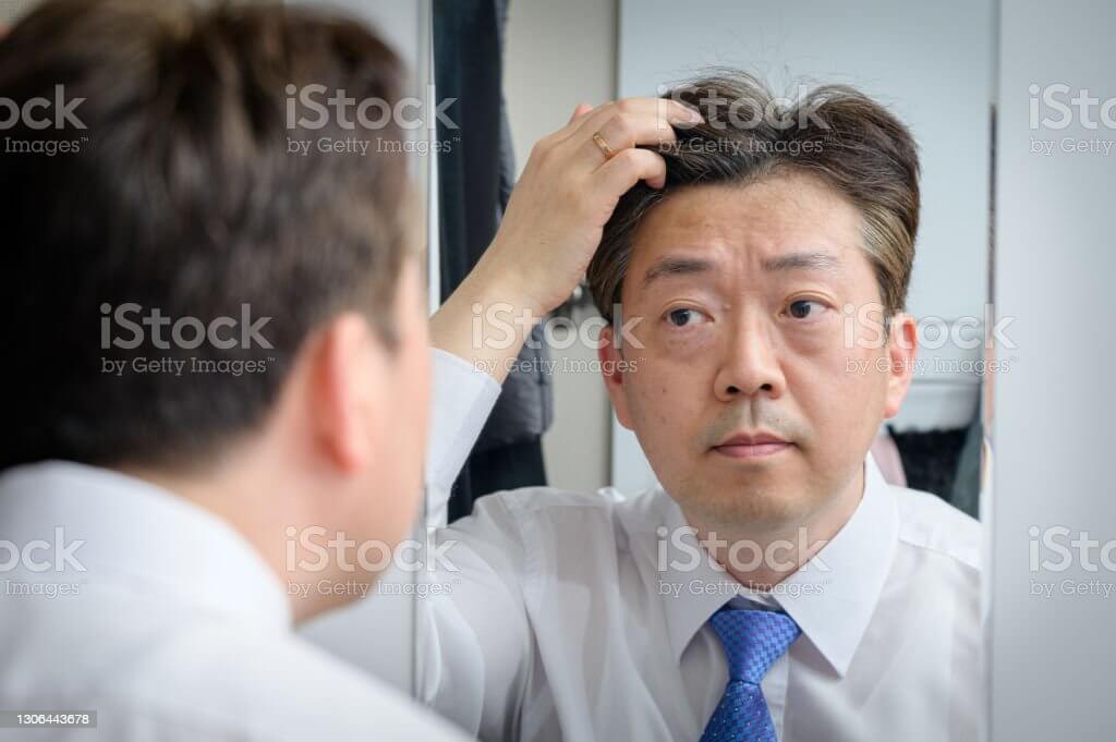 탈모 예방 방법