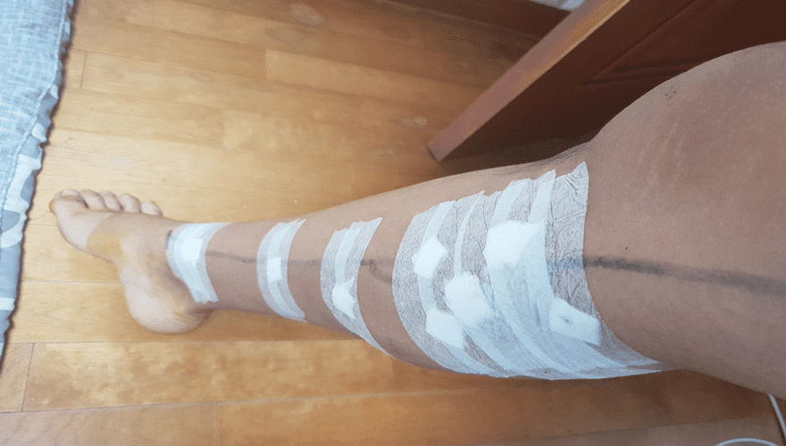 하얀색-거즈를-붙인-하지