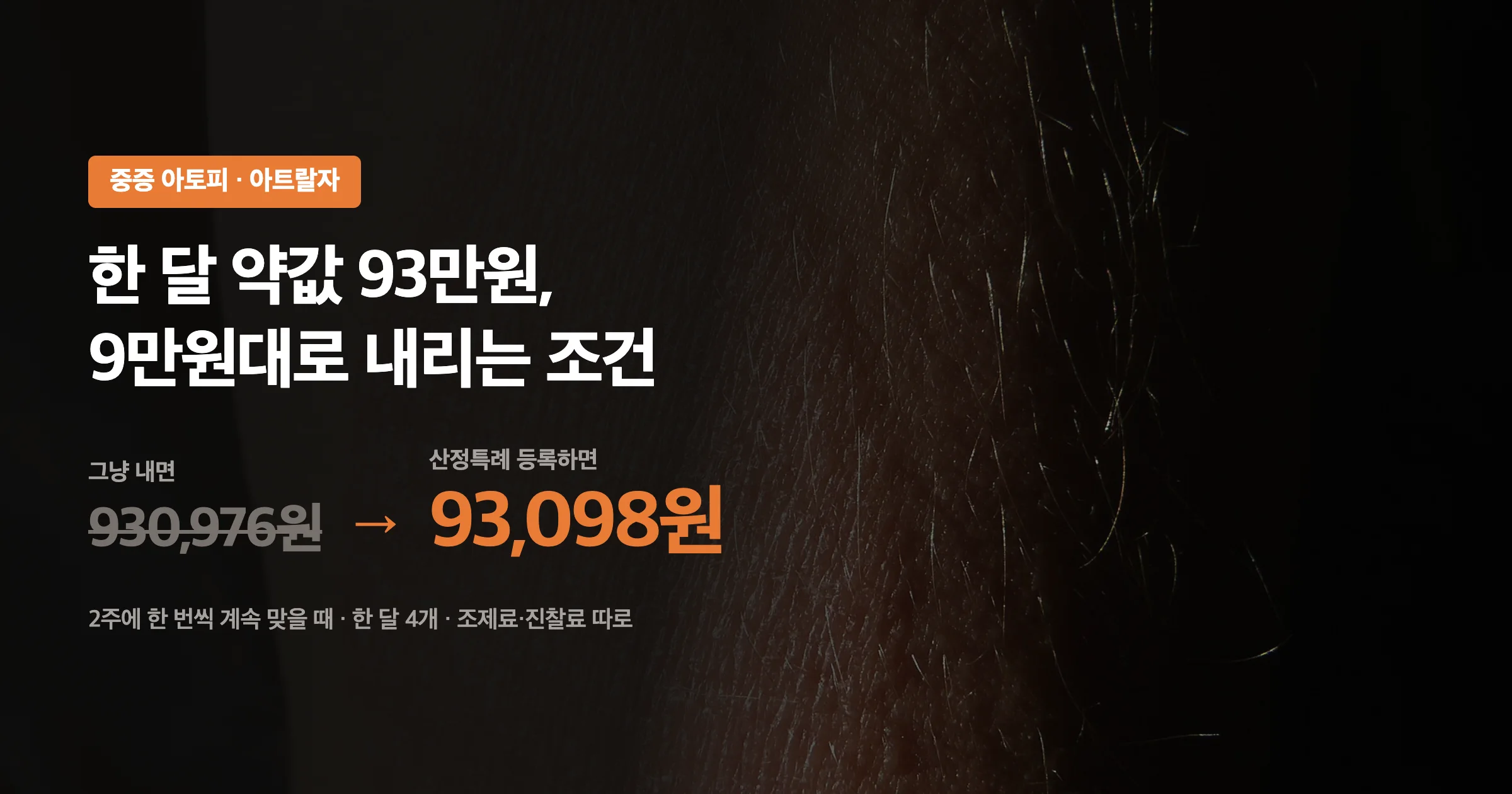 아트랄자 한 달 약값 930,976원이 산정특례 등록으로 93,098원이 된다는 요약 이미지