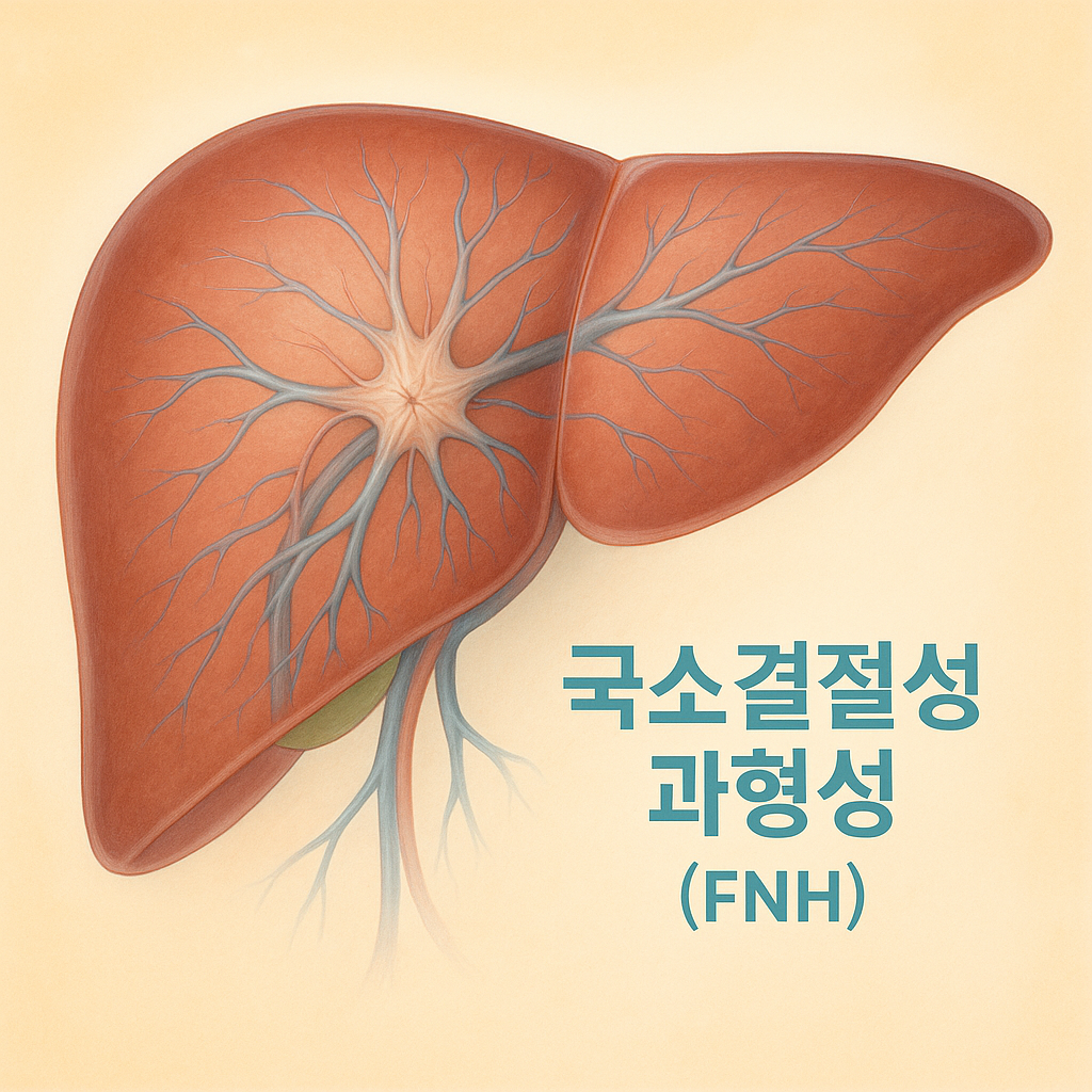 1.국소결절성 과형성