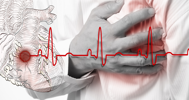 심부전증 관련 이미지