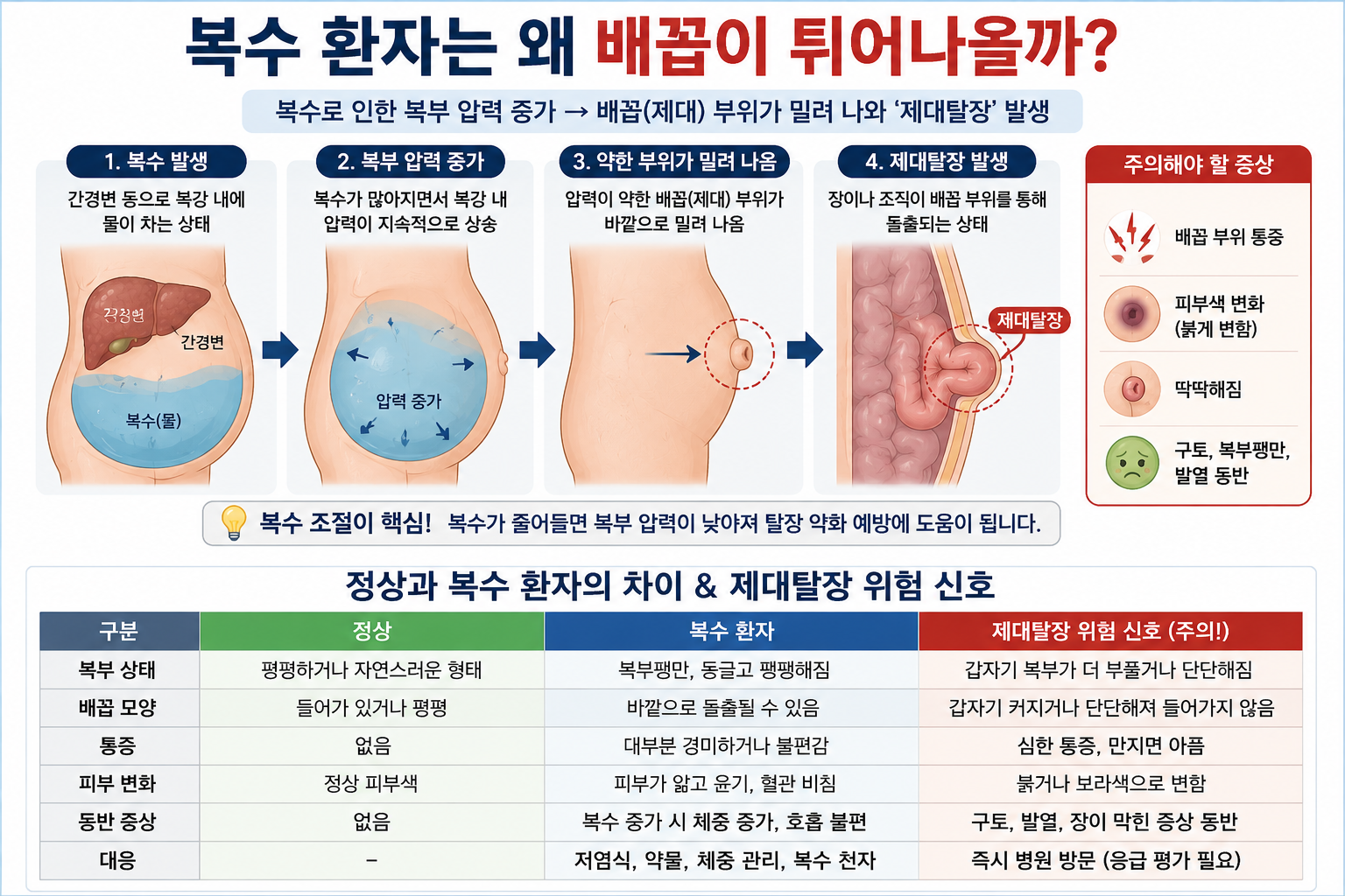복수 환자 제대탈장이 이루어지는 과정 설명 이미지