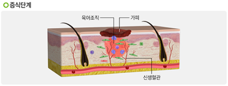 증식단계