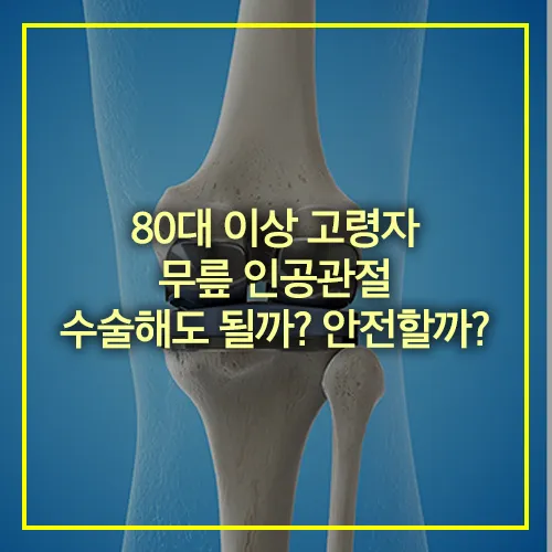 80대 이상 무릎 인공관절 수술 안전할까