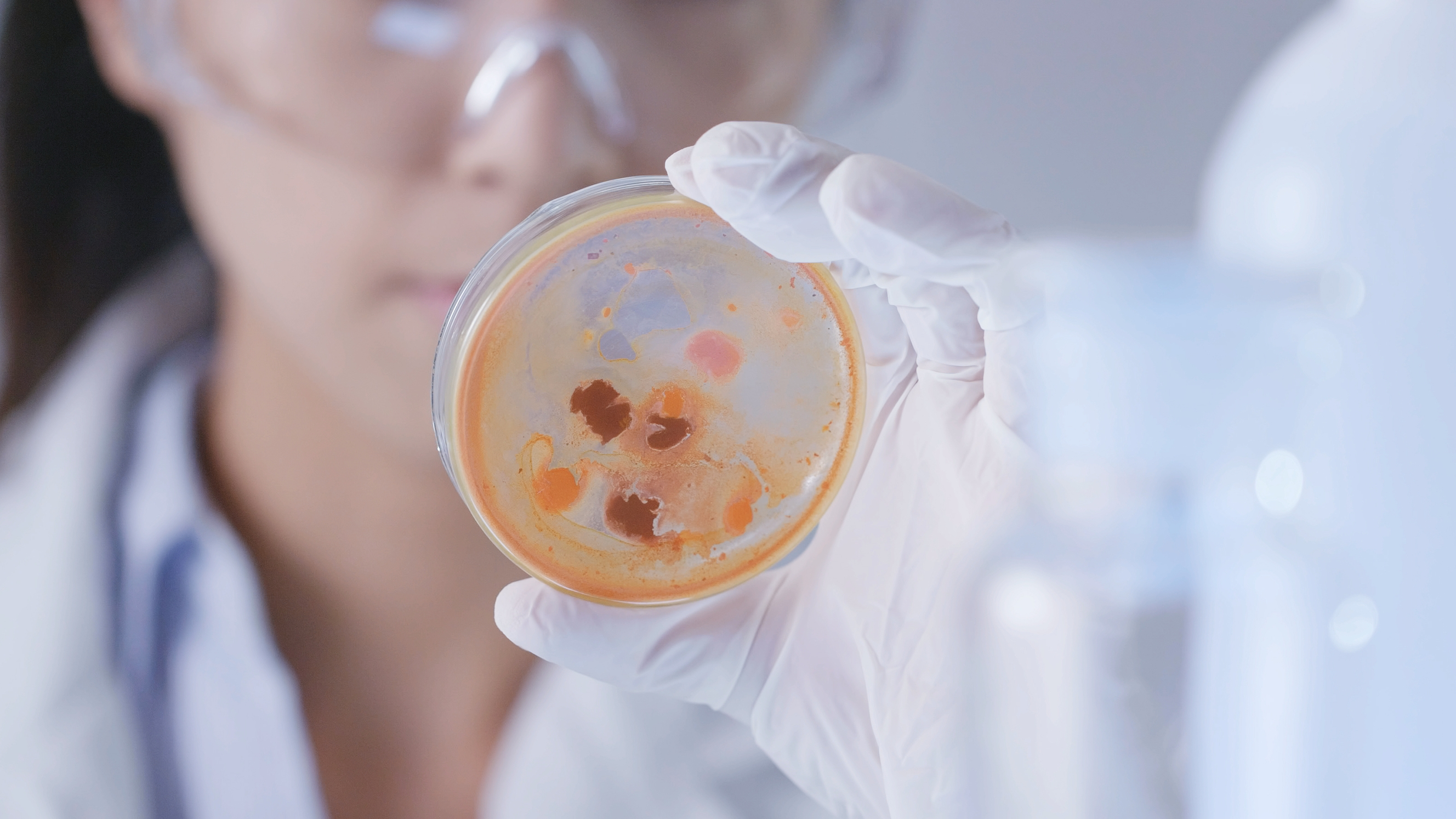 마이코플라즈마폐렴이란?