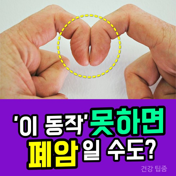 곤봉지 폐암 증상,진행 속도,건강 팁줌 매일꿀정보