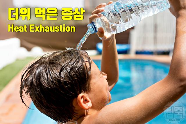 더위 먹은 증상 더위 먹었을때 대처 회복기간