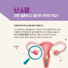#난소암 #부인과검진 #여성건강 #유전자검사 #BRCA유전자 #초음파검사 #예방적절제술 #항암치료 #표적치료제 #건강관리 #여성질환예방 #삼성서울병원 #조기진단 #건강정보 #건강블로그