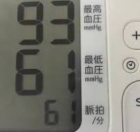 저혈압 증상과 원인