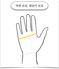막쥔 손금 or 원숭이 손금