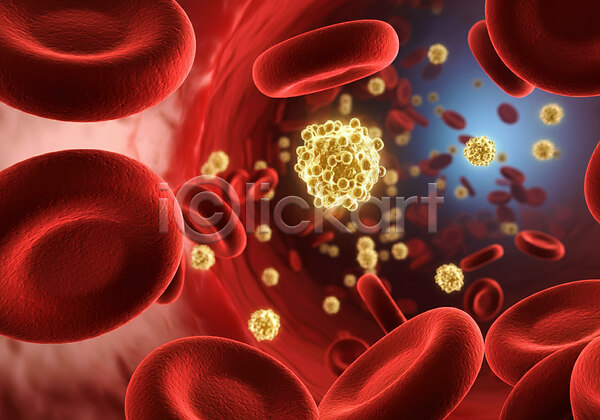 혈당스파이크 증상