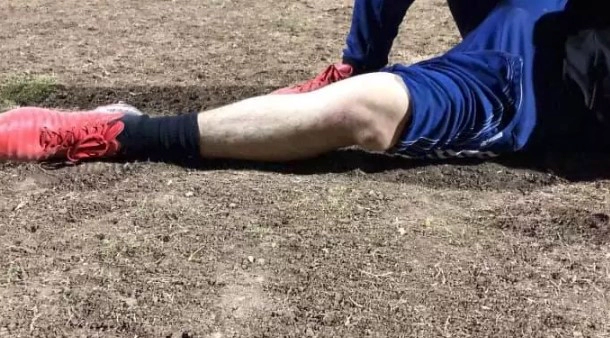 슬개골 탈구 재활 Tip