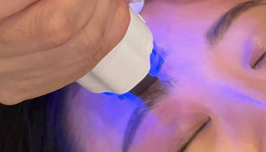 아이버츄 비용 후기 가격 부작용 피부과 시술 원리 눈가 고주파 리프팅 버츄RF