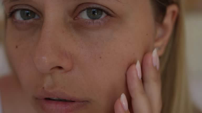 여드름 흉터와 모공 요철 관리? 매끈한 피부 만드는 법!