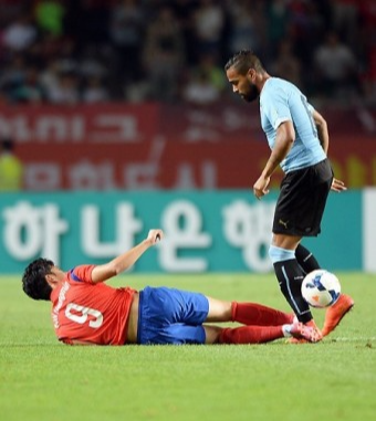 손흥민 안와골절 마스크