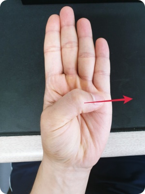 대동맥류-자가진단법