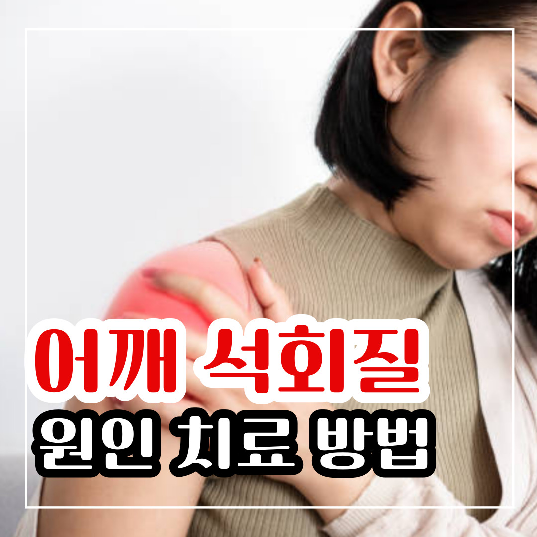 어깨 석회질치료방법과 석회화 원인 쉽게 알아보기