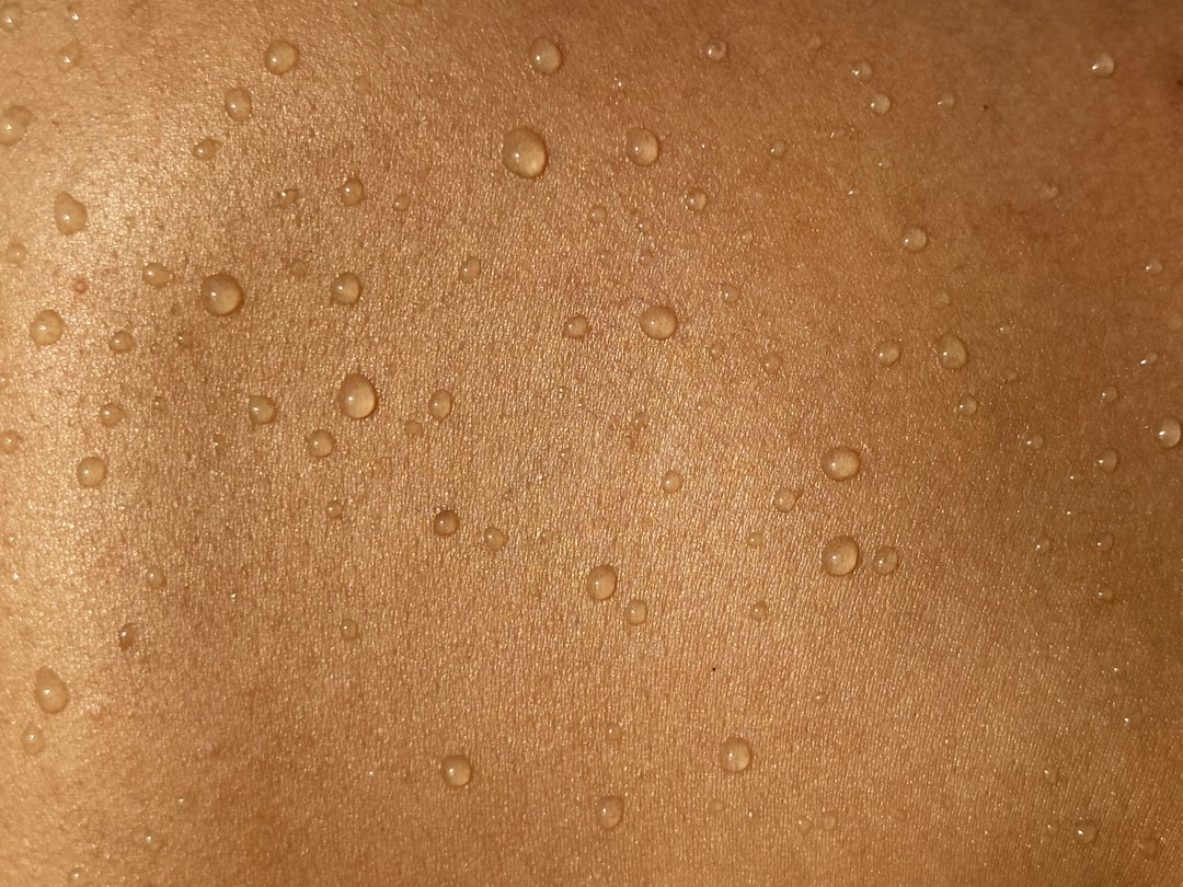 Atopic dermatitis