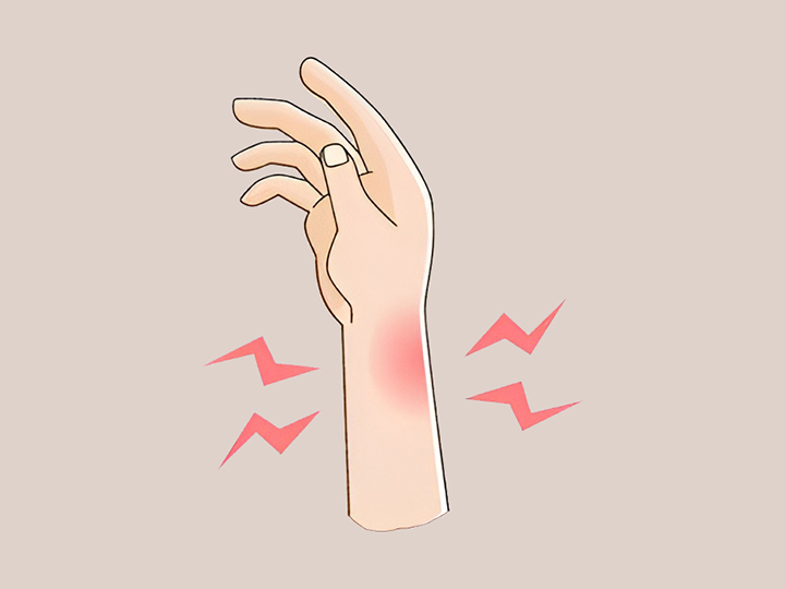 부기와-부종이-있는-손목