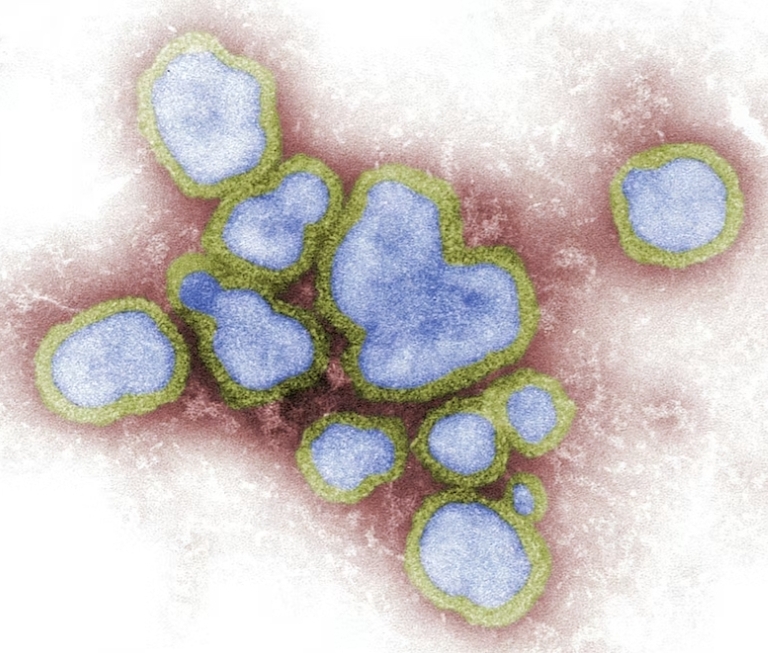 독감 감염 이미지