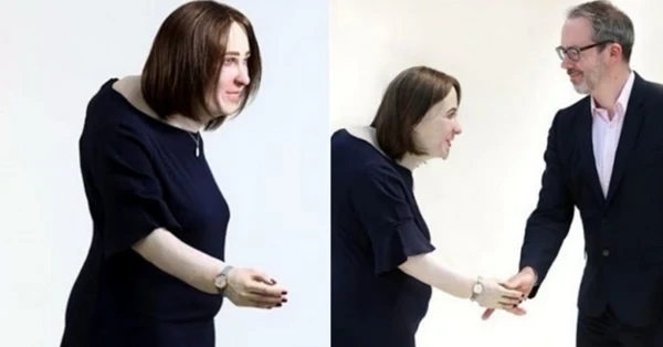 목과 어깨가 많이 굽은 여성 사진