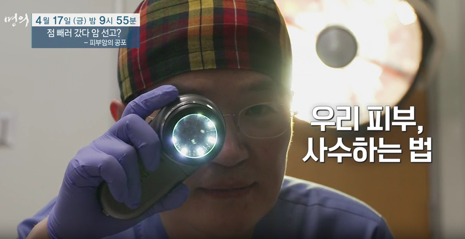 명의 피부암 점 구별법