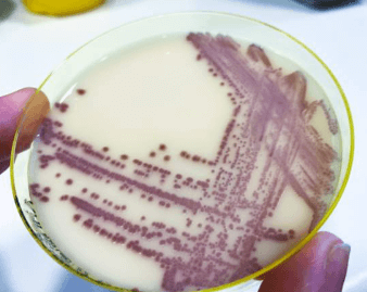 칸디다증 칸디다 감염 칸디다 치료 칸디다 증상 부위별 키워드 구강 칸디다증 (아구창) 질 칸디다증 피부 칸디다 식도 칸디다 칸디다 골관절염 칸디다 복막염 간비장 칸디다증 원인 및 치료 관련 키워드 칸디다증 원인 칸디다 감염 원인 칸디다증 치료법 칸디다 연고 칸디다 항진균제 칸디다증 면역력 강화 예방 및 생활습관 키워드 칸디다증 예방 칸디다에 좋은 음식 칸디다에 좋은 습관 항생제 부작용 칸디다 음식 관련 키워드 칸디다증에 좋은 음식 칸디다 억제 식품 마늘 칸디다 억제 칸디다 녹황색 채소 오메가3 칸디다 기타 연관 키워드 칸디다 전염성 칸디다증 생활 습관 칸디다증 자가진단 칸디다 곰팡이 감염 칸디다증 면역력