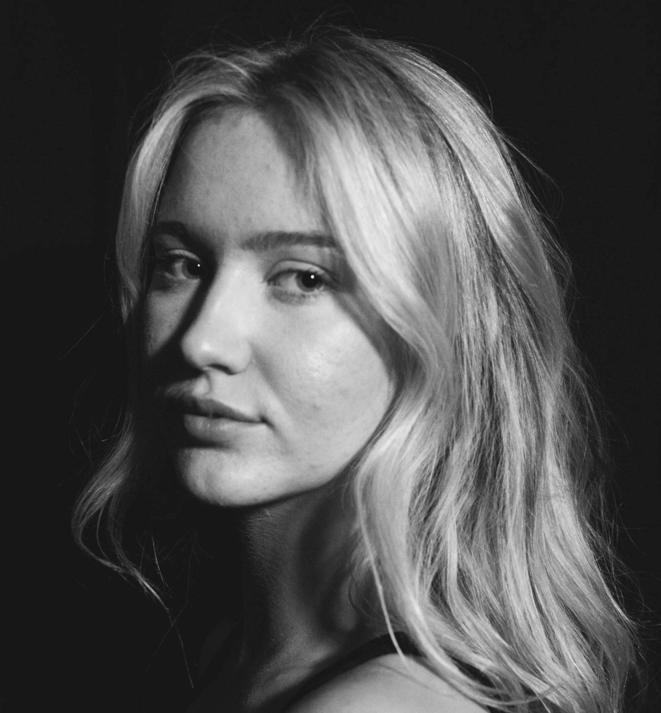 여드름 부위별 원인ㅣ 코, 이마, 턱, 가슴, 엉덩이 여드름