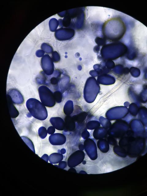 백혈구 수치 낮으면 일어나는 증상, 원인, 백혈구 수치에 좋은음식